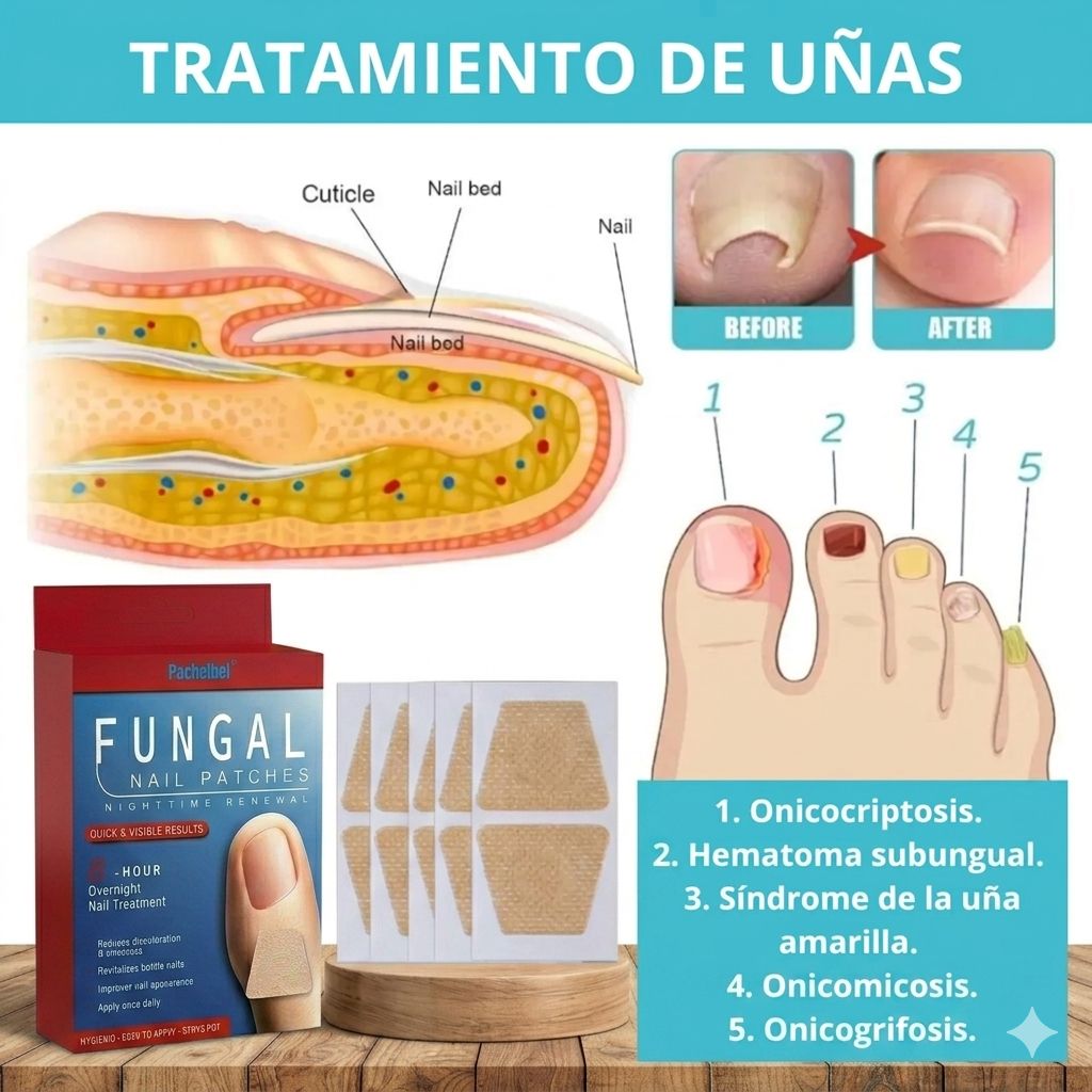 Parches para hongos de uñas x10 pcs. - Imagen 4