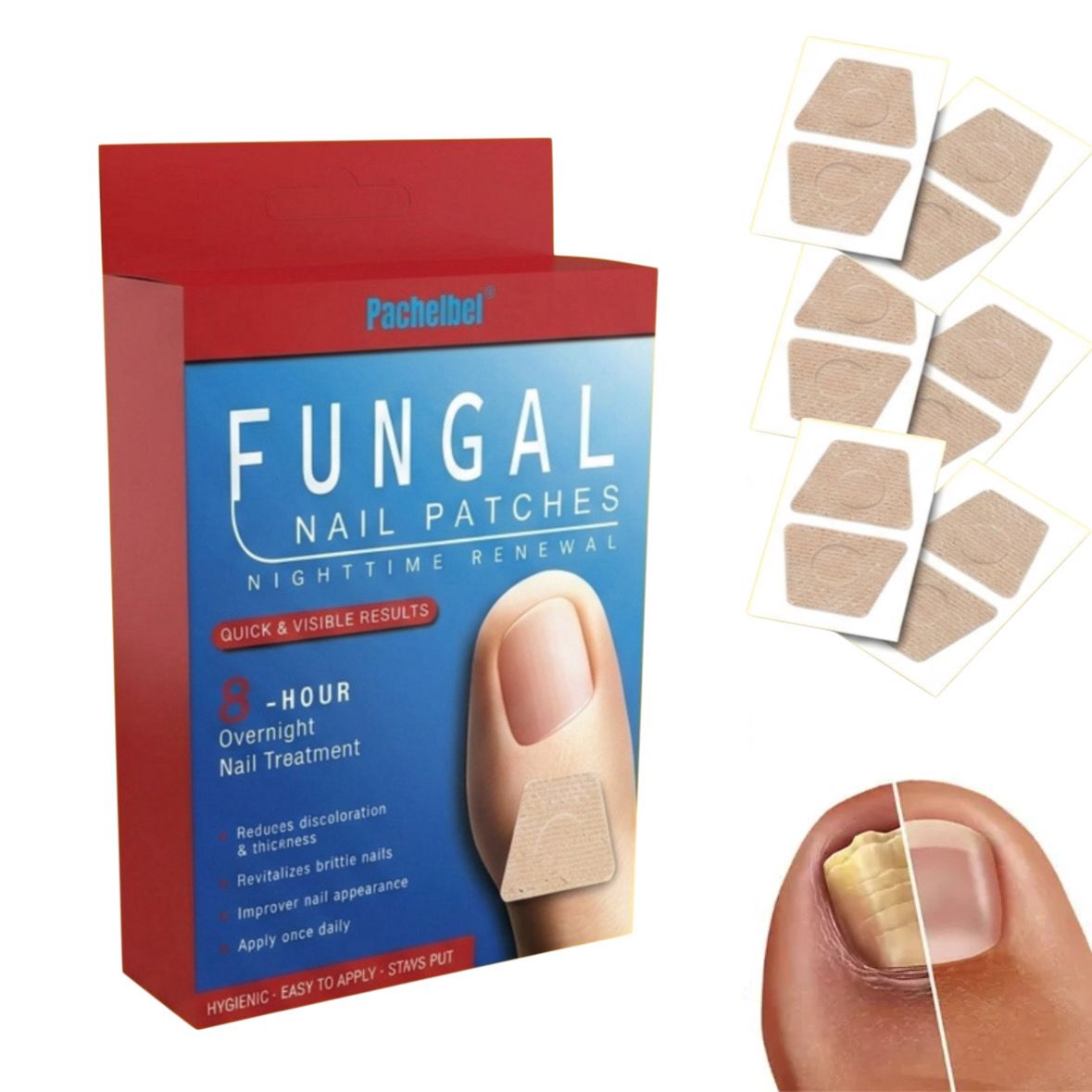 Parches para hongos de uñas x10 pcs.